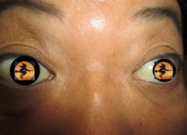 gelbe-super-originelle-kontaktlinsen-für-halloween