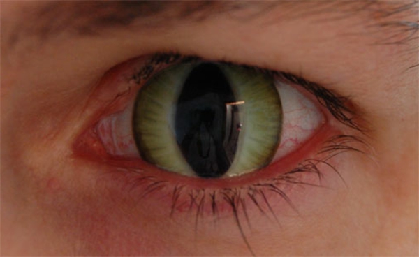 kontaktlinsen-für-halloween-wie-die-augen-einer-katze