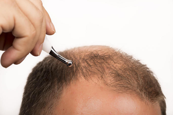 Was sollten Sie wissen, bevor Sie eine Haarklinik wählen
