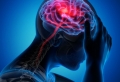 Tipps gegen Kopfschmerzen, um sie schnell ohne Medikamente zu lindern