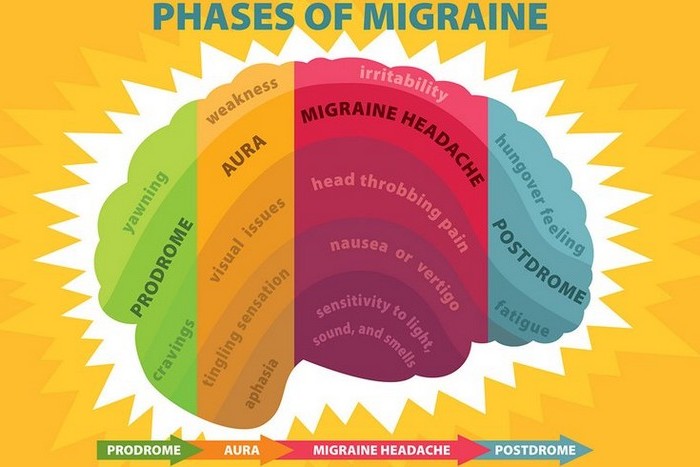 kopfschmerzen was tun starke kopfschmerzen migräne kophscmerzen arten migräne etapen grafik