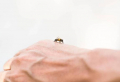 Was tun bei Wespenstich – Hilfreiche Tipps und Informationen
