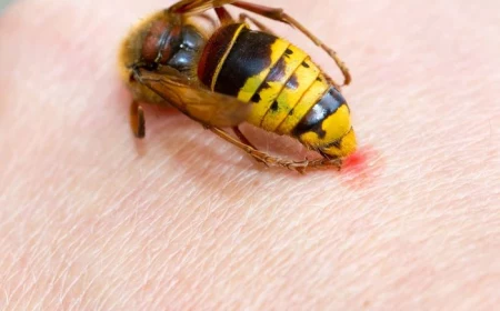 was tun bei wespenstich selbst gemachte heilmittel mit zwiebel knoblauch zitronensaft und essig