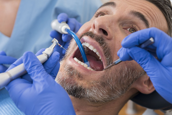 zahnnerv beruhigen hausmittel karies selbst behandeln entzündung im mund hausmittel zahnwurzenentzündung selbst heilen mahn beim zahnarzt geöffneten mund