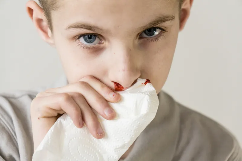 how to stop a nosebleed in a child