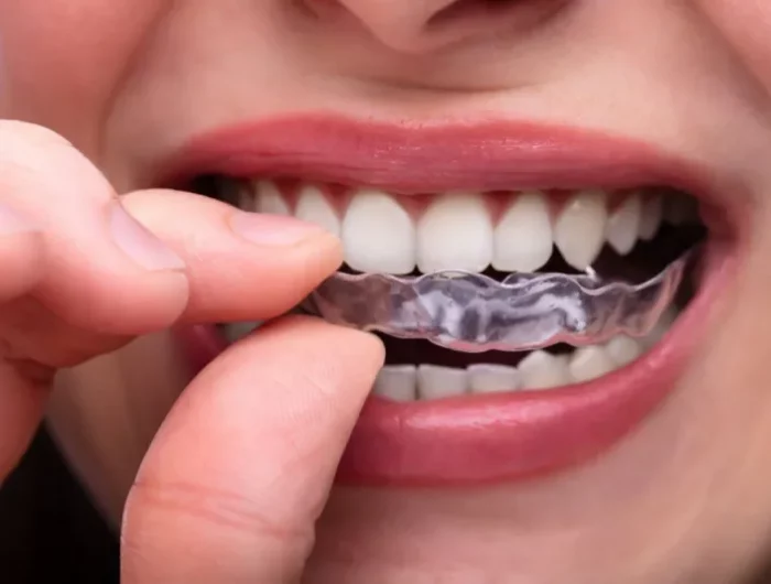 shnienen beim zähneknirschen schäden an den zähnen verhindern