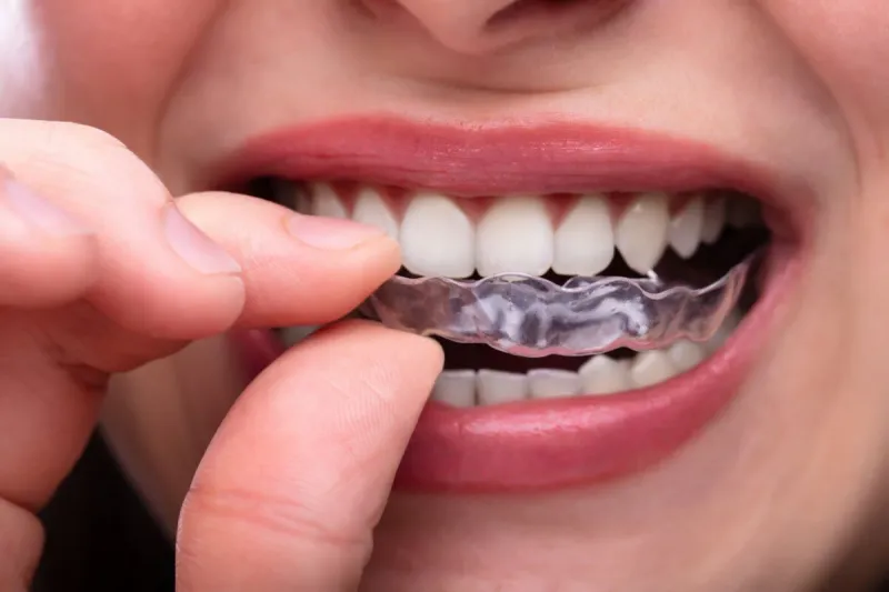 shnienen beim zähneknirschen schäden an den zähnen verhindern