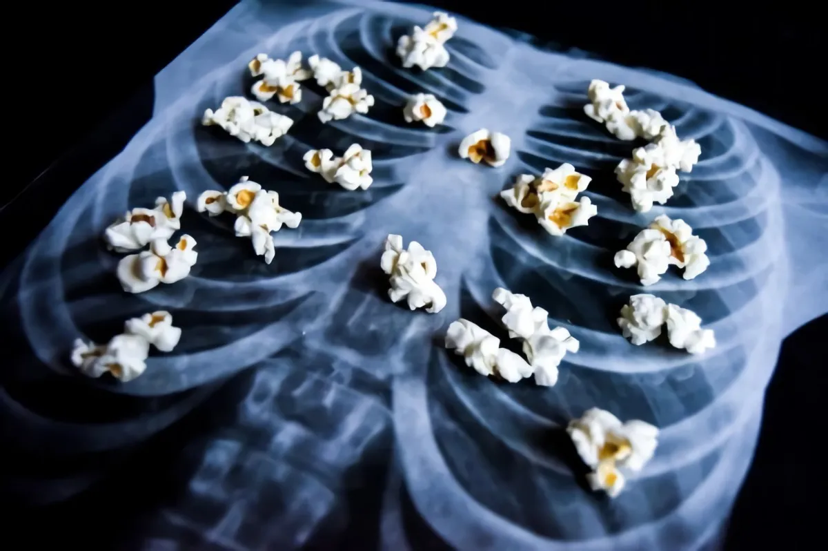popcorn lunge, verursacht durch dyacetil