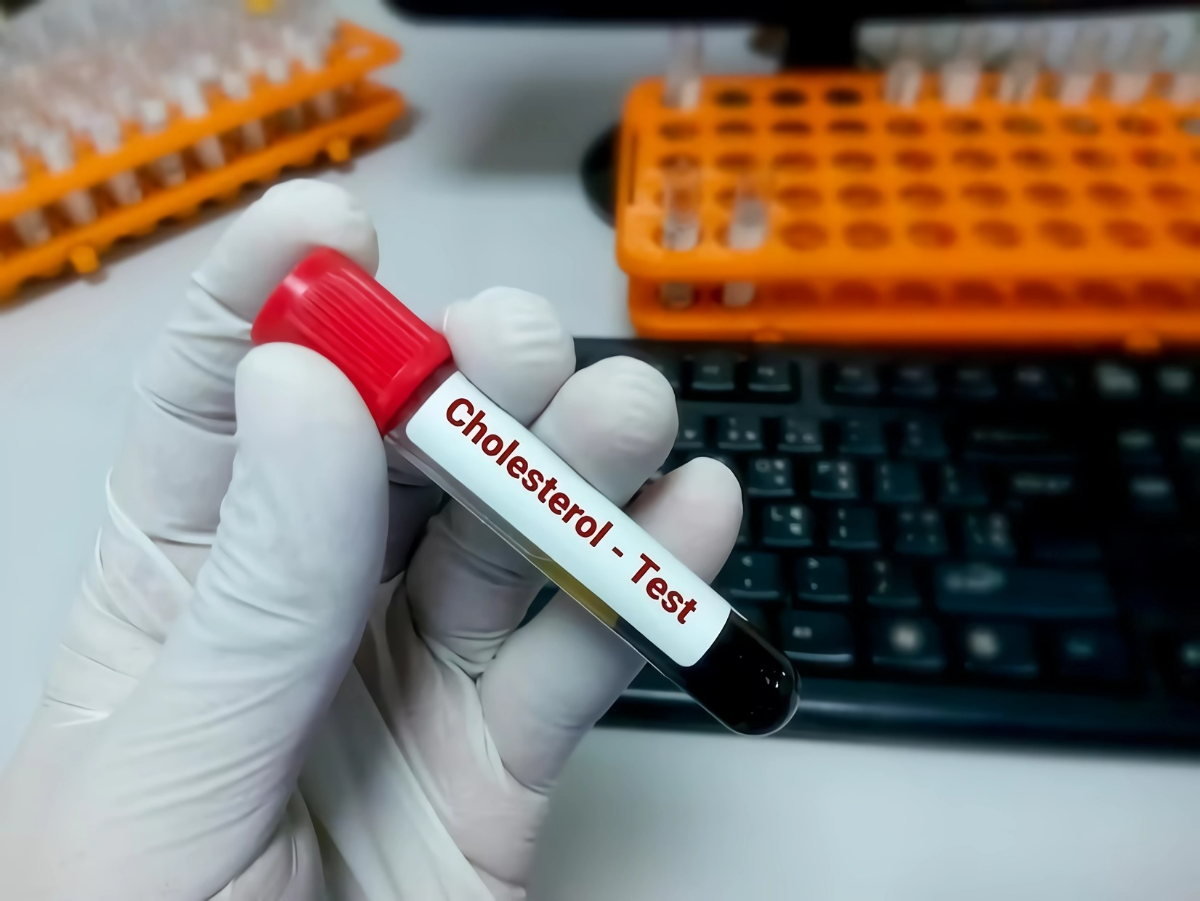 zu hohe cholesterinwerte feststellen cholesterin test