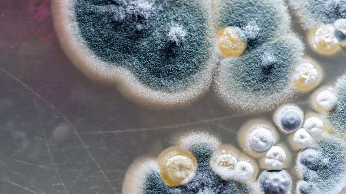 schimmelpilzsporen unter dem mikroskop gesehen