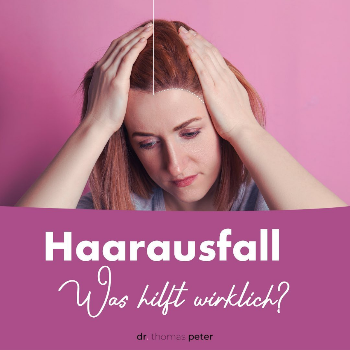 welche tipps gegen hormonell bedingten haarausfall