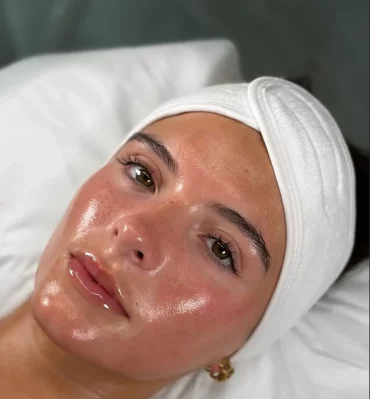 strahlende haut nach hydrafacial